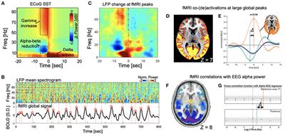 A Neurophysiological Event of Arousal Modulation May Underlie fMRI-EEG Correlations